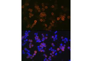 Immunofluorescence analysis of Raw264 7 cells using iNOS Rabbit mAb (ABIN1678965, ABIN3018084, ABIN3018085 and ABIN7101575) at dilution of 1:100 (40x lens).