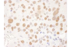 Immunohistochemistry (IHC) image for anti-Ubiquitin Specific Peptidase 7 (Herpes Virus-Associated) (USP7) (AA 1-50) antibody (ABIN7453454) (USP7 anticorps  (AA 1-50))