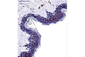 Immunohistochemistry analysis in formalin fixed and paraffin embedded human skin tissue using Tyrosinase Antibody (C-term) followed by peroxidase conjugation of the secondary antibody and DAB staining.