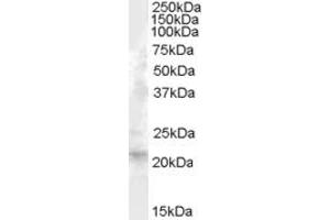 ABIN238569 (1µg/ml) staining of Human Liver lysate (35µg protein in RIPA buffer).