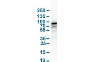 Western Blot analysis of human cell line RH-30. (NGFR anticorps  (AA 281-421))