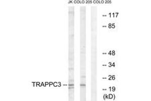 Western blot analysis of extracts from COLO/Jurkat cells, using TRAPPC3 Antibody. (TRAPPC3 anticorps  (AA 131-180))