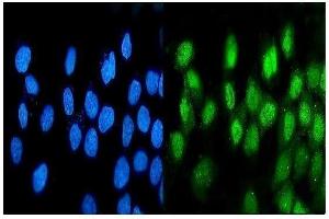 IF analysis of ATF1 using anti-ATF1 antibody (ABIN7599192).