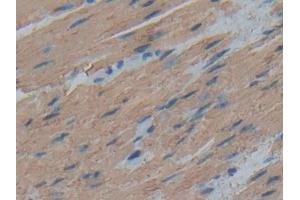 DAB staining on IHC-P; Samples: Human Esophagus Tissue (ACTC1 anticorps  (AA 156-368))