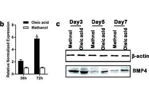 BMP4 expression is elevated during Oleic acid-induced triglyceride/lipid accumulation in hepatocytes and in a mouse model of NAFLD. (BMP4 anticorps)