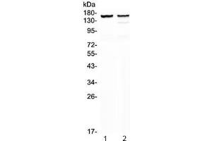 Western blot testing of 1) rat heart and 2) mouse heart lysate with MYBPC3 antibody at 0. (MYBPC3 anticorps)