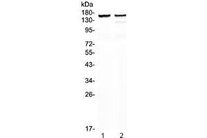 Western blot testing of 1) rat heart and 2) mouse heart lysate with MYBPC3 antibody at 0.