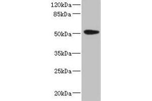 Western blot All lanes: KRT35 antibody at 4 μg/mL + PC-3 whole cell lysate Secondary Goat polyclonal to rabbit IgG at 1/10000 dilution Predicted band size: 51 kDa Observed band size: 51 kDa (Keratin 35 anticorps  (AA 1-455))