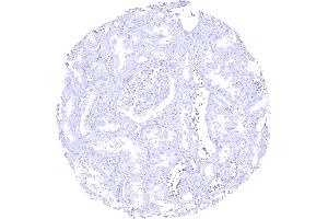 CELA3B immunostaining is absent in kidney tissue (Recombinant Elastase 3B anticorps  (AA 82-238))
