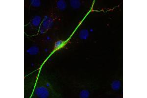 Indirect immunostaining of PFA fixed rat hippocampus neurons with anti-synaptoporin (1 : 500; red) and mouse anti-MAP 2 (, dilution 1 : 500; green). (Synaptoporin anticorps  (C-Term))