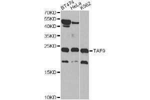 Western blot analysis of extracts of various cell lines, using TAF9 antibody (ABIN5971055) at 1/1000 dilution. (TAF9 anticorps)