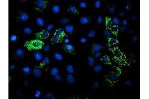 Image no. 4 for anti-Dihydrolipoamide Dehydrogenase (DLD) antibody (ABIN1497849) (DLD anticorps)