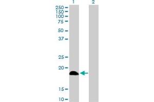 Western Blot analysis of DCTD expression in transfected 293T cell line by DCTD MaxPab polyclonal antibody. (DCMP Deaminase (DCTD) (AA 1-189) anticorps)