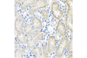Immunohistochemistry of paraffin-embedded mouse kidney using PSTPIP1 antibody (ABIN5975180) at dilution of 1/100 (40x lens). (PSTPIP1 anticorps)