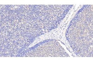 Detection of EMR1 in Human Lymph node Tissue using Polyclonal Antibody to EGF Like Module Containing Mucin Like Hormone Receptor 1 (EMR1)