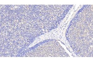 Detection of EMR1 in Human Lymph node Tissue using Polyclonal Antibody to EGF Like Module Containing Mucin Like Hormone Receptor 1 (EMR1) (F4/80 anticorps  (AA 1-201))