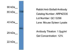 Host:  Rabbit  Target Name:  SLC6A9  Sample Tissue:  Mouse Spleen  Antibody Dilution:  1ug/ml (GLYT1 anticorps  (C-Term))