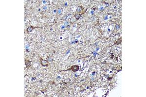 Immunohistochemistry of paraffin-embedded Mouse spinal cord using GULP1 Rabbit pAb (ABIN6131564, ABIN6141541, ABIN6141542 and ABIN6220256) at dilution of 1:100 (40x lens). (GULP1 anticorps  (AA 1-130))