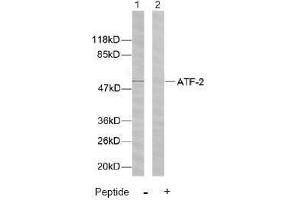 Image no. 2 for anti-Activating Transcription Factor 2 (ATF2) (Ser44), (Ser62) antibody (ABIN197144) (ATF2 anticorps  (Ser44, Ser62))