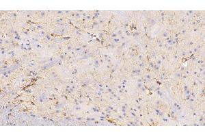 Detection of GFAP in Mouse Spinal cord Tissue using Polyclonal Antibody to Glial Fibrillary Acidic Protein (GFAP)