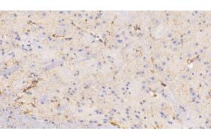 Detection of GFAP in Mouse Spinal cord Tissue using Polyclonal Antibody to Glial Fibrillary Acidic Protein (GFAP) (GFAP anticorps  (AA 253-354))