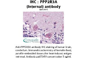 Image no. 1 for anti-Protein Phosphatase 2, Regulatory Subunit B'', alpha (PPP2R3A) (Internal Region) antibody (ABIN1738304) (PPP2R3A anticorps  (Internal Region))