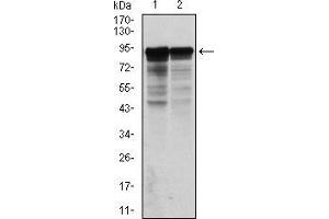 Western blot analysis using NEFL mouse mAb against Hela (1) and Jurkat (2) cell lysate. (NEFL anticorps)