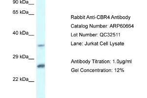 Western Blotting (WB) image for anti-Carbonyl Reductase 4 (CBR4) (C-Term) antibody (ABIN2788530)