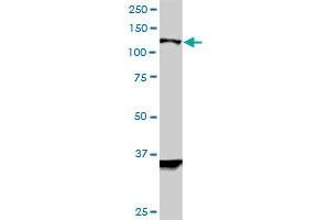 HIP1R monoclonal antibody (M01), clone 3E10.