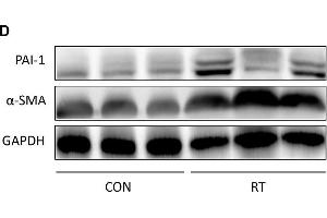 Establishment and confirmation of radiation-induced lung fibrosis in a murine model. (GAPDH anticorps)