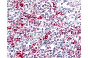 Anti-CCR6 antibody IHC of human tonsil. (CCR6 anticorps  (C-Term))