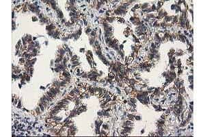 Image no. 8 for anti-Catenin (Cadherin-Associated Protein), beta 1, 88kDa (CTNNB1) antibody (ABIN1496888)