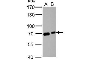WB Image GAD67 antibody detects GAD67 protein by western blot analysis.
