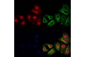 anti-Glutathione Transferase zeta 1 (Maleylacetoacetate Isomerase) (GSTZ1) (C-Term) antibody
