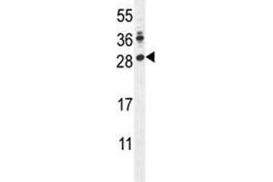 LIN28A antibody western blot analysis in mouse Neuro-2a lysate. (LIN28A anticorps  (AA 108-138))