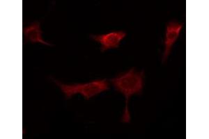 ABIN6267280 staining Hela by IF/ICC. (RAF1 anticorps  (pSer296))