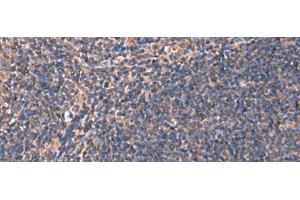 Immunohistochemistry of paraffin-embedded Human tonsil tissue using RHAG Polyclonal Antibody at dilution of 1:130(x200) (RHAG anticorps)