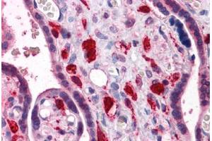 Human Placenta: Formalin-Fixed, Paraffin-Embedded (FFPE)