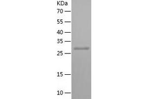 Western Blotting (WB) image for Parafibromin (CDC73) (AA 2-260) protein (His-IF2DI Tag) (ABIN7124308)