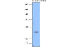 Western Blotting (WB) image for anti-Ubiquitin Carboxyl-terminal Esterase L1 (Ubiquitin Thiolesterase) (UCHL1) (AA 1-223) antibody (ABIN377235) (UCHL1 anticorps  (AA 1-223))