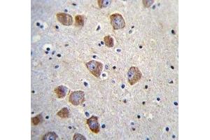 DBH antibody immunohistochemistry analysis in formalin fixed and paraffin embedded human brain tissue.