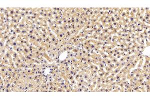 Detection of AST in Mouse Liver Tissue using Monoclonal Antibody to Aspartate Aminotransferase (AST)