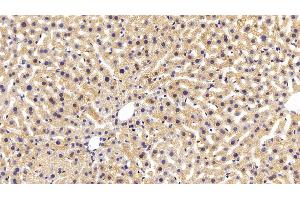 Detection of AST in Mouse Liver Tissue using Monoclonal Antibody to Aspartate Aminotransferase (AST) (GOT1 anticorps  (AA 1-413))