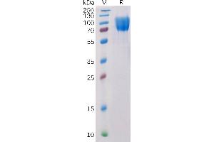 Human CD117 Protein, His Tag on SDS-PAGE under reducing condition.