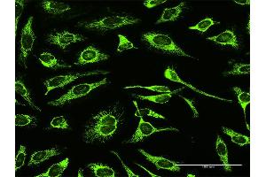 Immunofluorescence of purified MaxPab antibody to TRAP1 on HeLa cell.