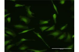 Immunofluorescence of purified MaxPab antibody to MDM4 on HeLa cell. (MDM4-binding Protein anticorps  (AA 1-490))