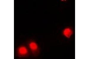 Immunofluorescent analysis of CHD4 staining in HEK293 cells. (CHD4 anticorps)