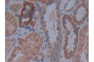 DAB staining on IHC-P; Samples: Human Kidney Tissue