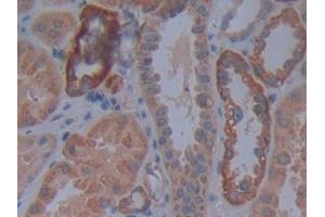 DAB staining on IHC-P; Samples: Human Kidney Tissue (Cadherin 4 anticorps  (AA 667-916))