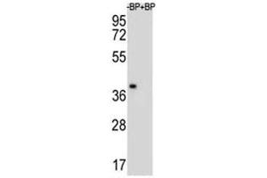 Western blot analysis of MBP antibody and NCI-H460 lysate.